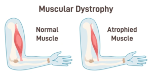 Common Clinical Indicators